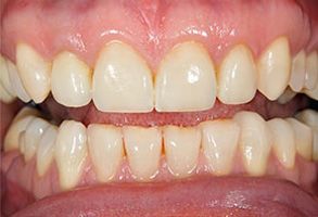 Barboursville dental images