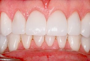 Barboursville dental images