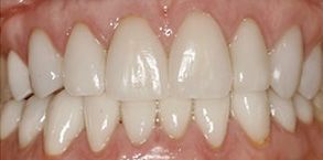 Milton dental images