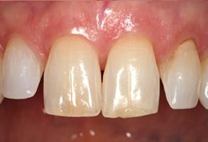 Huntington dental images